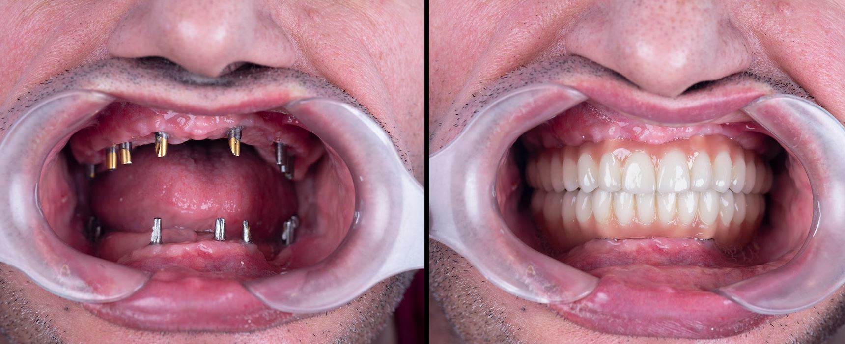 How Technological Innovations Improve Dental Care Delivery The