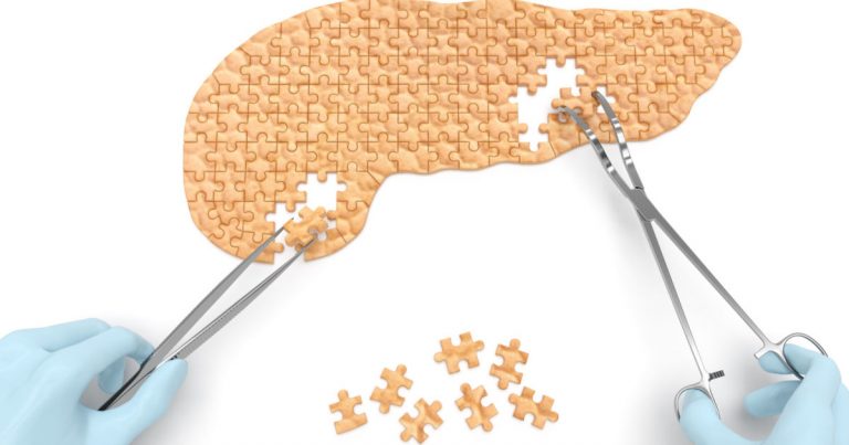 Artificial pancreas uses your phone to counter diabetes