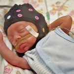 AI Reads Brainwaves to Assess Preterm Brain Maturity