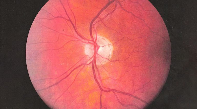 Google Neural Network Can Predict Your Health Status From Your Retina