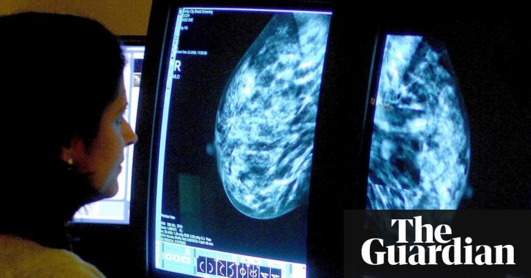 Up to 270 women may have died after breast cancer screening IT error