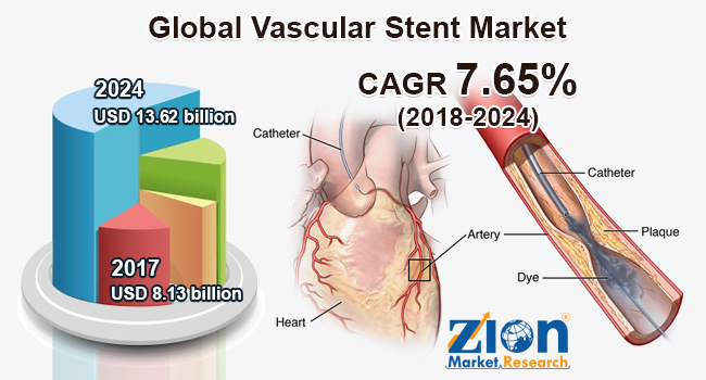 Global Vascular Stent Market Worth USD 13.62 Billion By 2024
