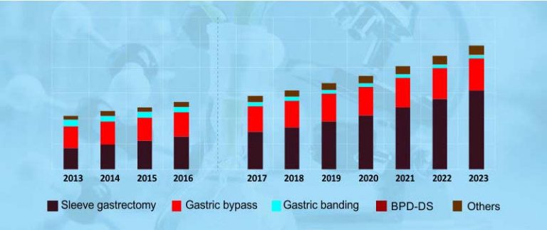 Obesity, Bariatric Surgery Devices Market Worldwide Top Key Players Revenue and Demand Forecasts to 2023