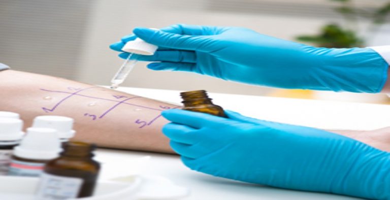 Is Penicillin Allergy Skin Testing on your Radar?