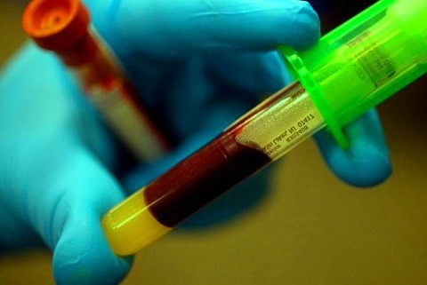 Blood Collection Market Overview, Share, Growth and Demand Forecast by 2024 : psmrblog