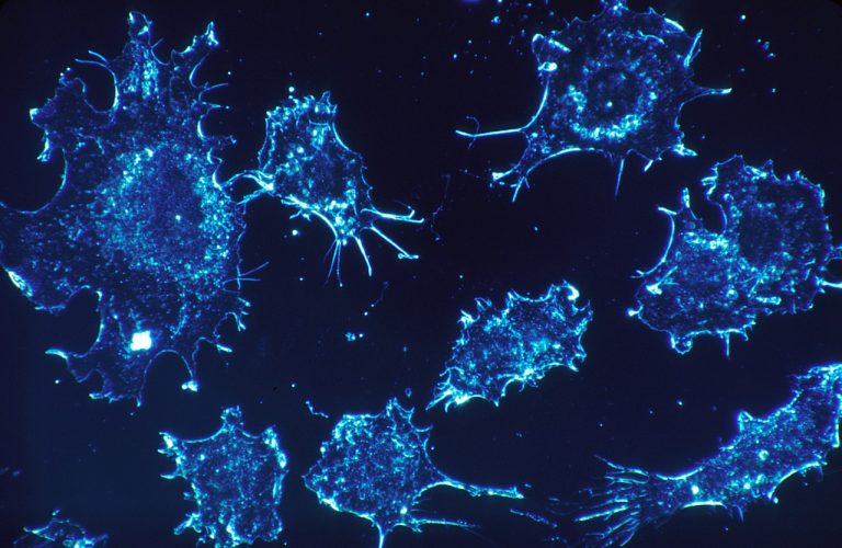 What You Need To Know About PFAS Cancer Lawsuits
