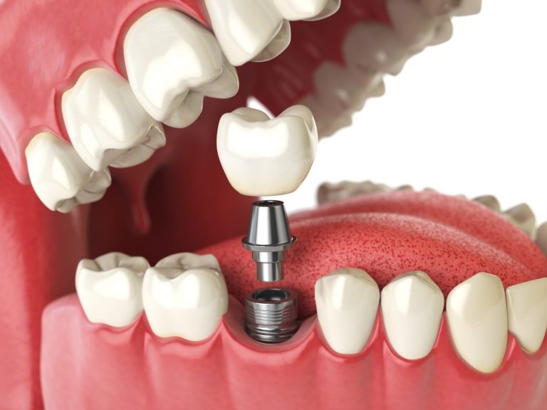 Modern Family Dentistry: Practical Strategies for Lifelong Oral Health and Periodontal Care