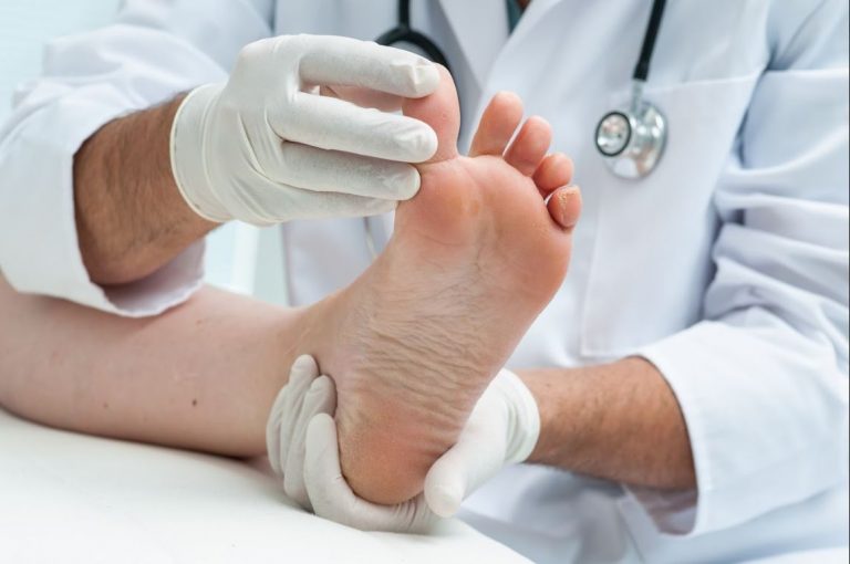 5 Latest Treatments for Athlete’s Foot