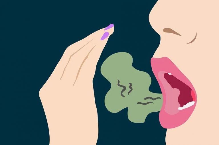 10 Reasons That Leads to Bad Breath and How to Get Rid of It