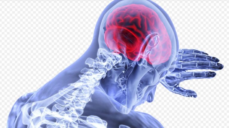 How To Consult A Board-Certified Neurologist Online