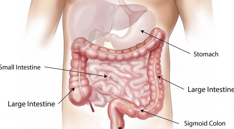 Soothing Solutions for Irritable Bowel Syndrome