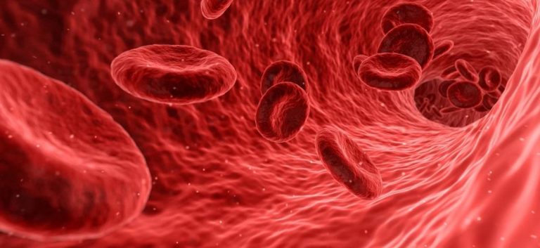 5 Common Signs and Symptoms of Iron-Deficient Anemia