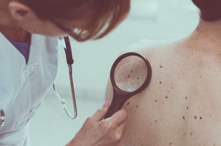 Why to Check for Skin Cancer Regularly