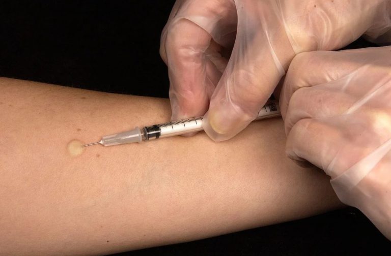 Site Selections for Tuberculosis Clinical Trials