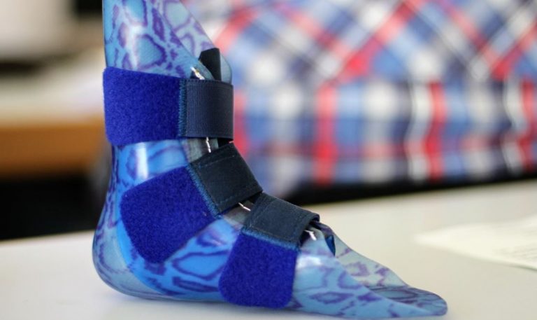 Essential Factors to Consider when Choosing Orthotics & Prosthetics Services