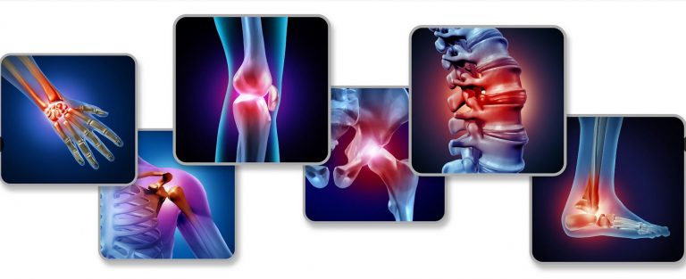 Active Release Therapy: What Is It And When Do You Need It?