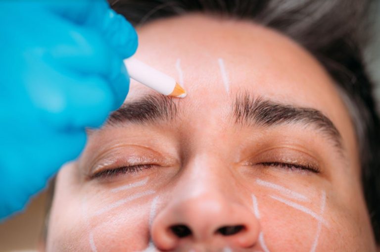 A Guide To Injectable Dermal Fillers For Men