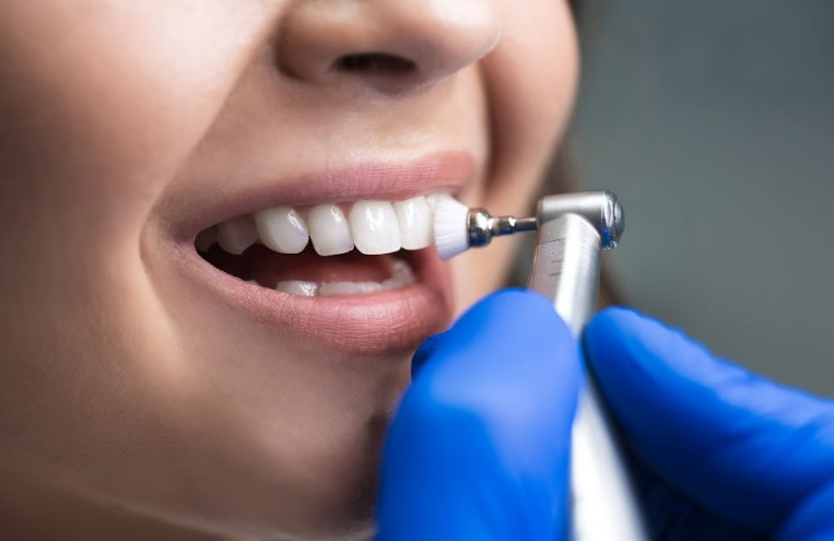How Regular Dental Cleaning Ensures Optimum Oral Health