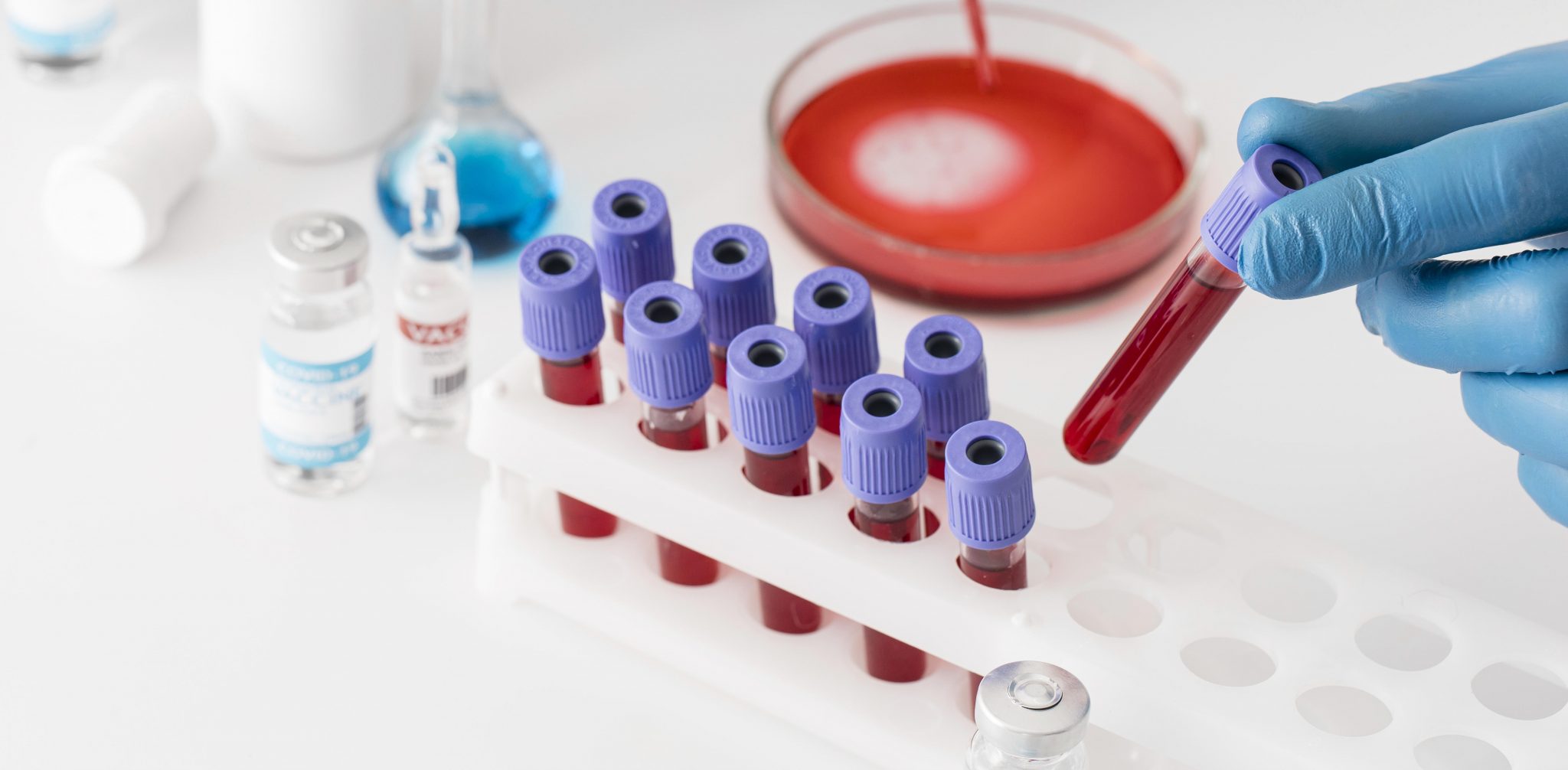 Medical Device Sampling Methods Best Practices for Handling and Storing Medical Samples | The ...