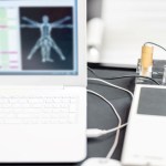 Chronic condition_02