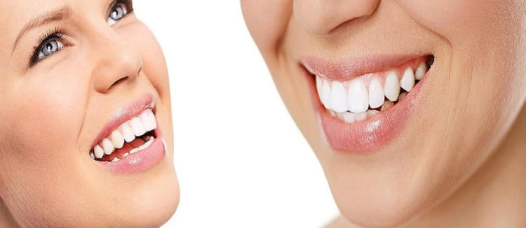The Impact of Veneers on Oral Health: Insights from London’s Top Dentists