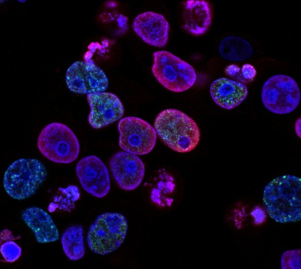 Safety and Risks of Stem Cell Therapy: What You Need to Know