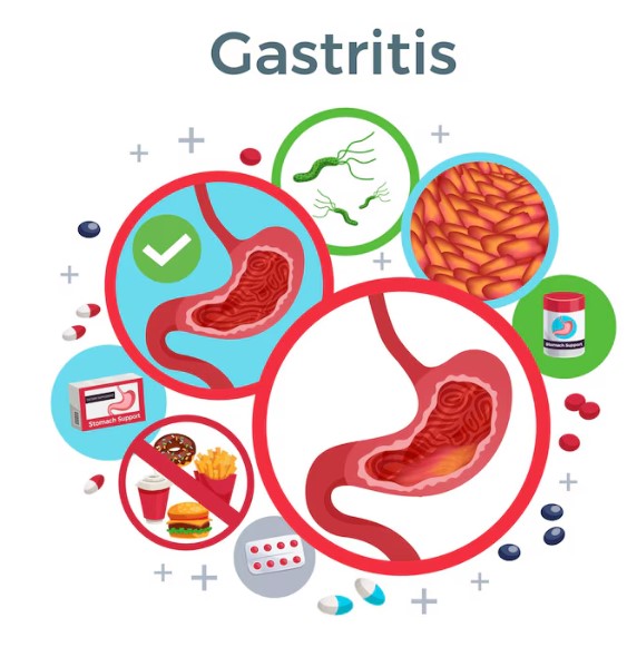 Unlocking the Secrets of Gastroenterological Health: A Comprehensive Guide for Modern Healthcare