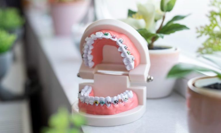 Virtual orthodontic consultations advancing remote care for better outcomes