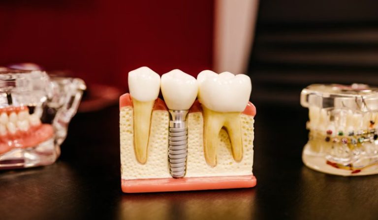 Unveiling the Mind-Body Connection: How Dental Health Influences Your Overall Wellbeing