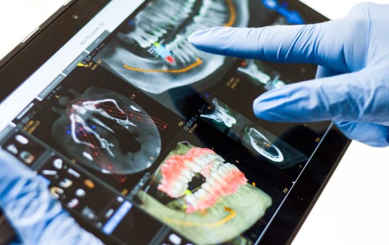 The Complete Guide to Ceramic Veneers: Transform Your Smile with Confidence