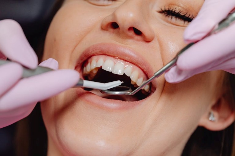 What Your Gums Are Telling You About Your Health