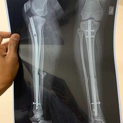 The Future of Orthopedic Care: Tech-Driven Knee Pain Solutions