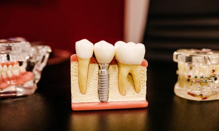Dental implants in Leighton Buzzard: trust Premier Smile Dental Excellence