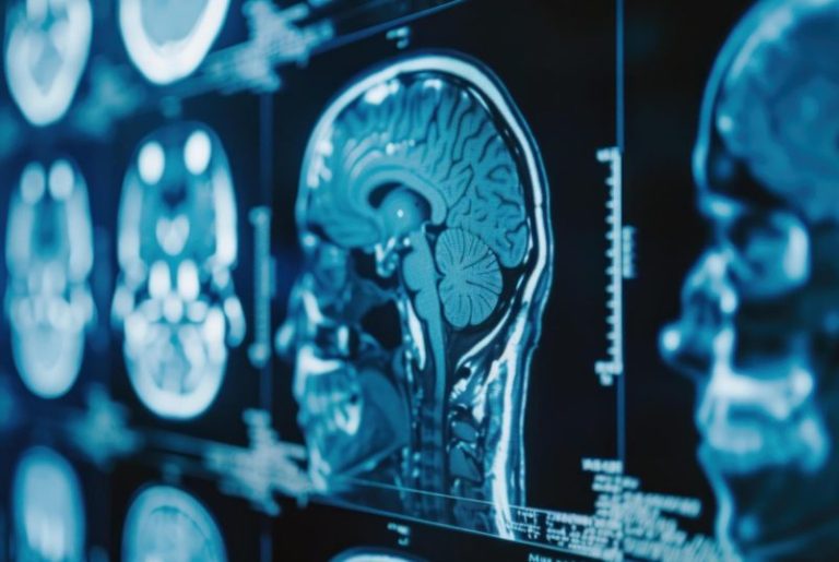 A new era in imaging – how United Imaging Healthcare makes examinations more precise and safe?