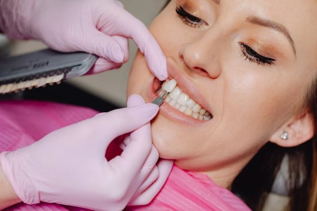 Benefits of Dental Veneers and Why People Choose Them