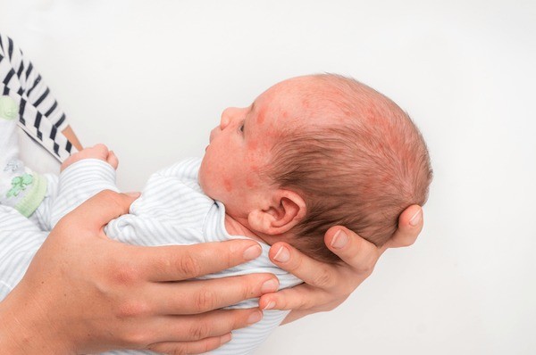 Signs Your Baby May Have Suffered a Birth Injury During Delivery