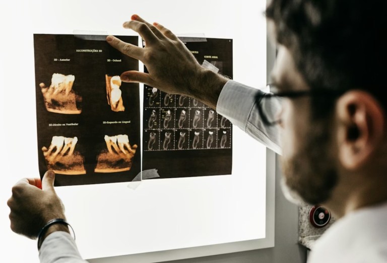 AI Full Arch Implant System Is Rebuilding Full Mouth Rehabilitation