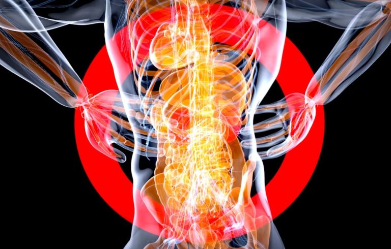 When Should You Get Help for Sciatica?