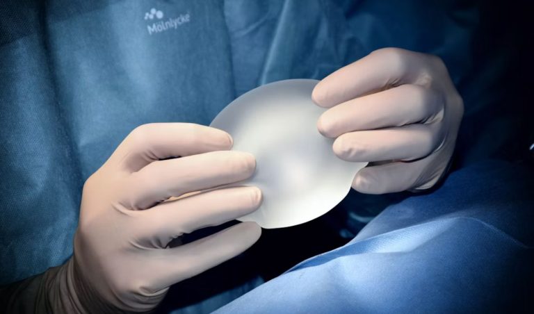 Are Breast Implants Safe? Here’s What the Research Actually Says