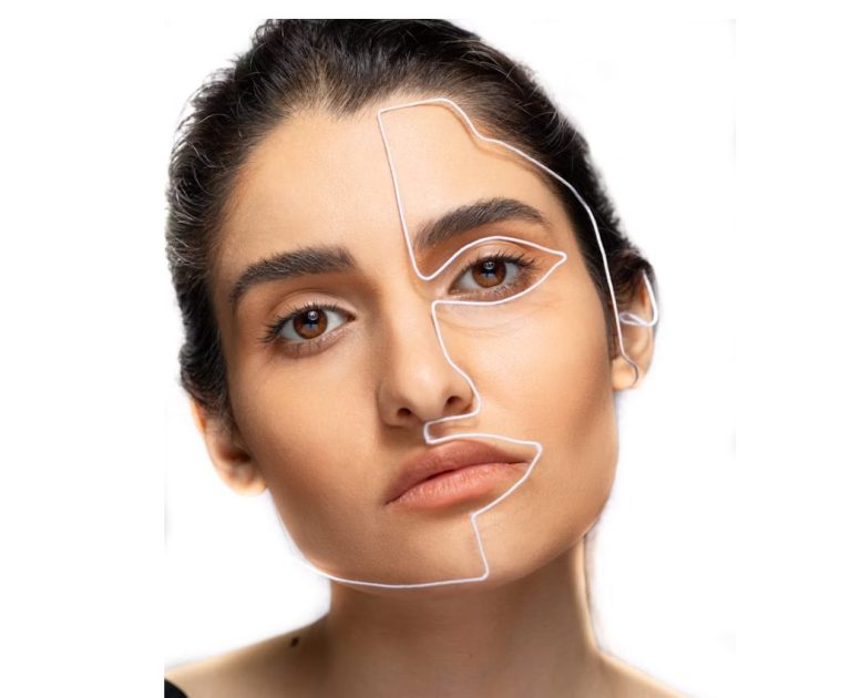 Key Factors That Influence Your Facelift Results (And How to Get Them Right)