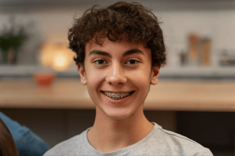 Beyond Braces: Exploring Modern Options for Straightening Teeth