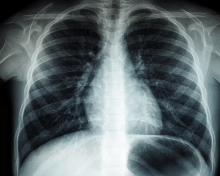 The Future Radiologist May Not Read the Whole Study Alone